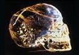 craniile-th[1].jpg