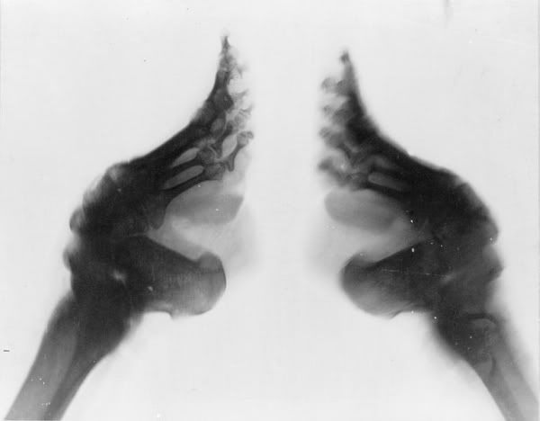 bound-feet-x-ray.jpg